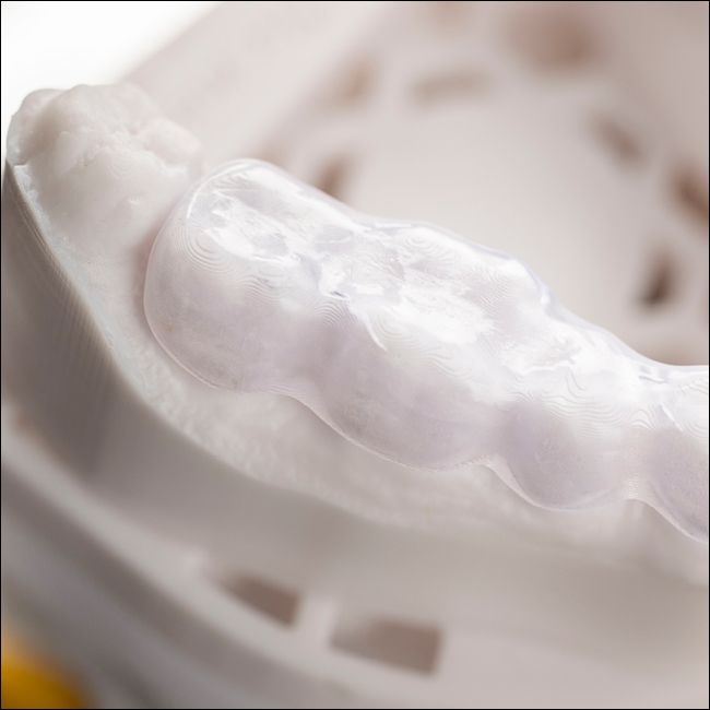 SHERAPRINT SPLINT