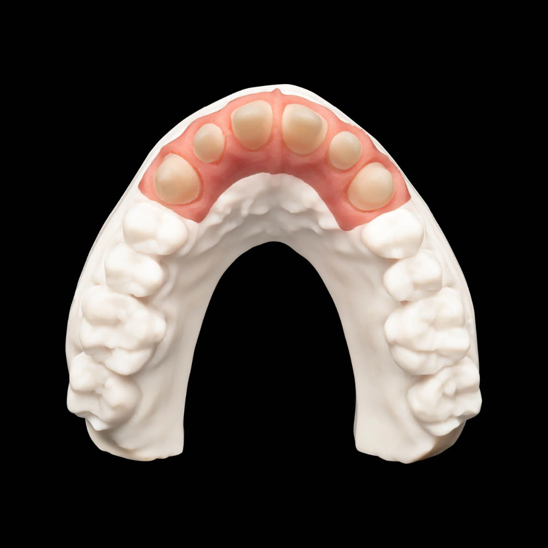 SHERAPRINT GINGIVA 2.0